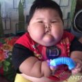 Anak-anak obesitas di Bekasi menjalani rawat jalan intensif