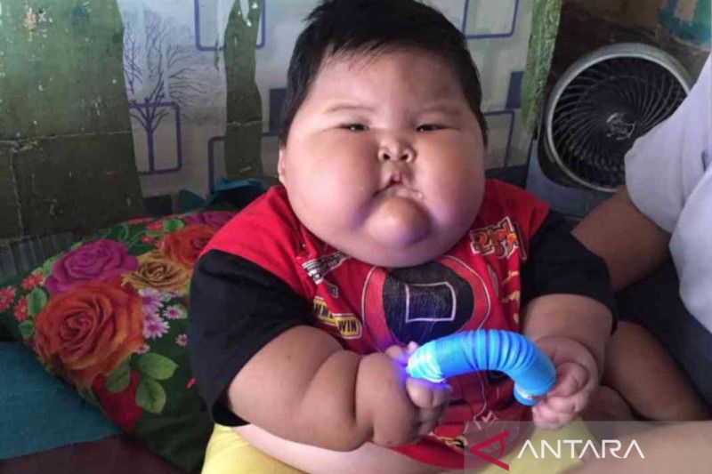 Anak-anak obesitas di Bekasi menjalani rawat jalan intensif